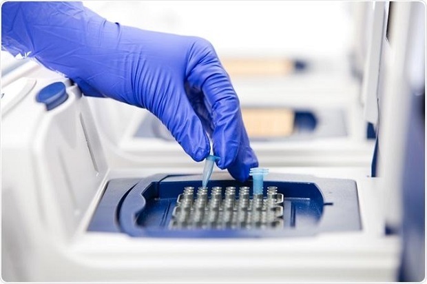Marché mondial des technologies PCR