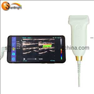 Dispositivos de ultrasonido de diagnóstico Doppler tipo D Oferta-demanda del mercado
